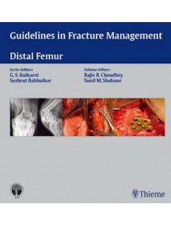 Guidelines in Fracture Management- Distal Femur